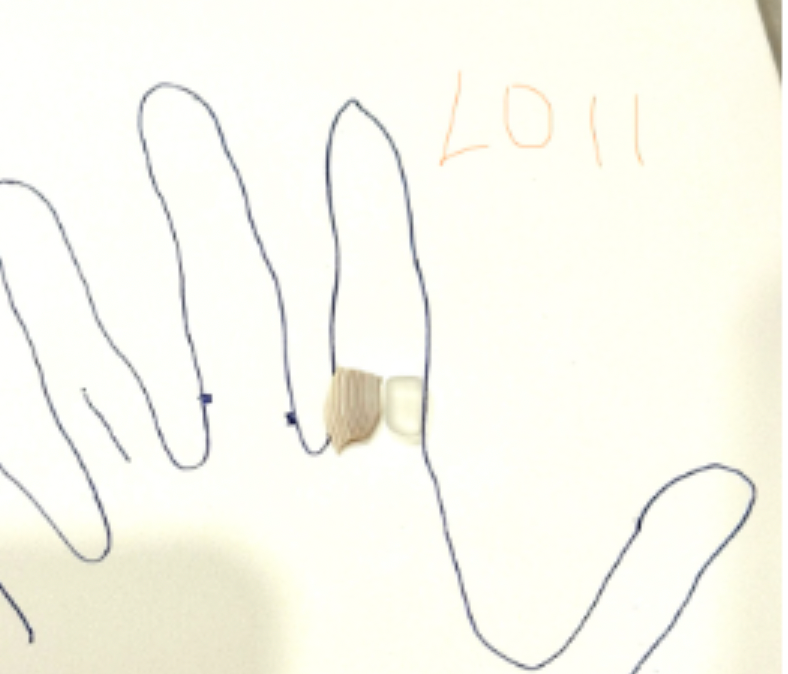 Angel Ring
